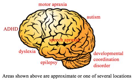 Neuro-Developmental Disorders - Neuroneeds