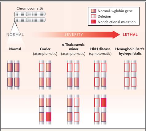 Taste of Home: Alpha Thalassemia Trait with preview total 26+ Images