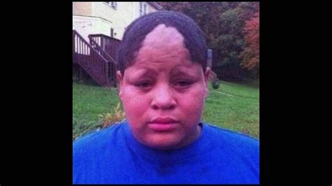 Bad Worst Hairlines