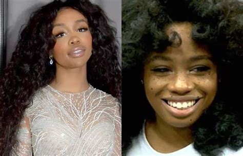 Before and After SZA Plastic Surgery Comparison - Your Daily Dose Of News