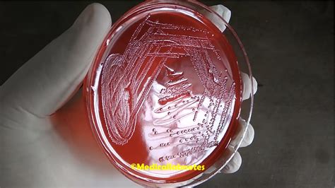 XLD Agar: Introduction, Composition, Principle, Preparation, Test