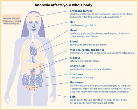 Difference Between Anorexia and Anorexia Nervosa | Compare the Difference Between Similar Terms