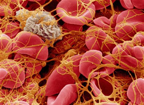 Microgel Particles Boost Blood Clotting | National Institutes of Health ...