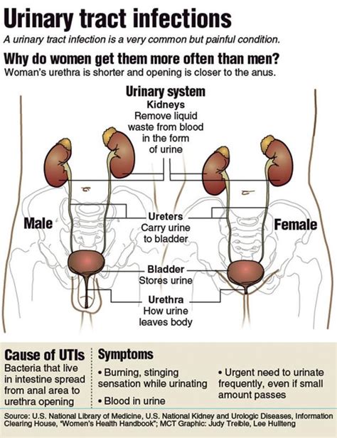 Stop those UTIs: Infection is common among women | MLive.com