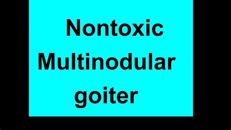 Nontoxic Multinodular goiter - YouTube