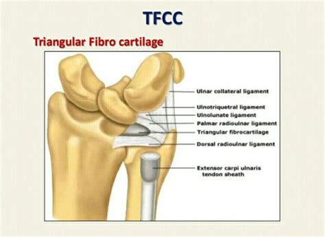 The triangular fibrocartilage complex (TFCC) is a cartilage structure located on the small ...