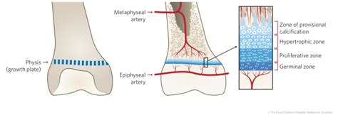 Long Bone Diagram Growth Plate / Growth Plate Fractures Ortho Illinois ...