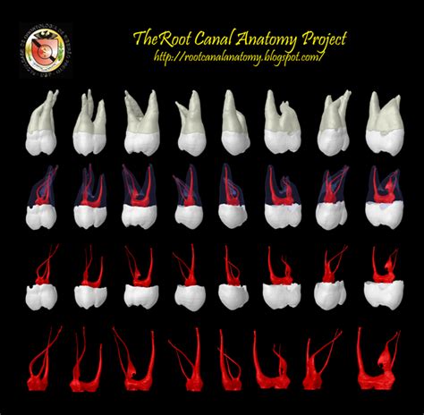 The Root Canal Anatomy Project: Maxillary Second Molar