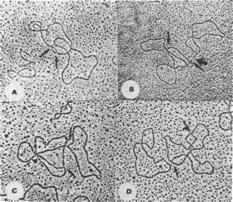 Electron micrographs of SV40 DNA connected to a replication... | Download Scientific Diagram