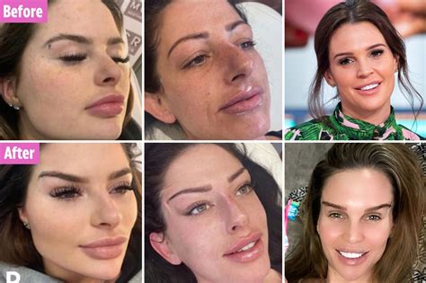 'Fox eye' surgery is the new big trend Danielle Lloyd loves but it ...