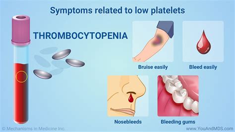 Symptoms related to low platelets Platelets are the cells that help your blood clot normally. If ...