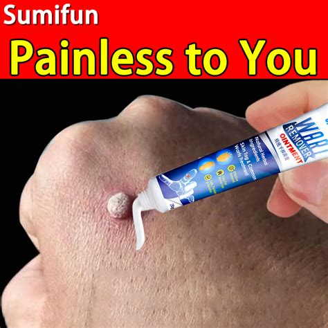 SUMIFUN Warts Remover Original Cream painless Wart remover Ointment 20g ...