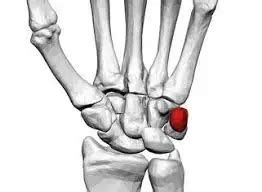 Pisiform Bone - Anatomy, Structure, Function