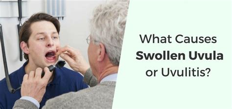 Swollen Uvula (Uvulitis): Causes, Symptoms & Natural Treatments