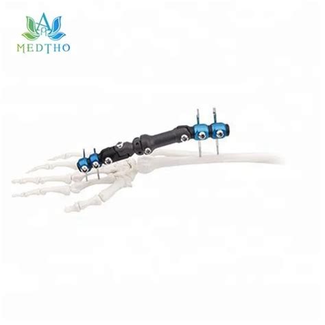 Orthopedic External Fixation External Fixator Wrist Joints External ...