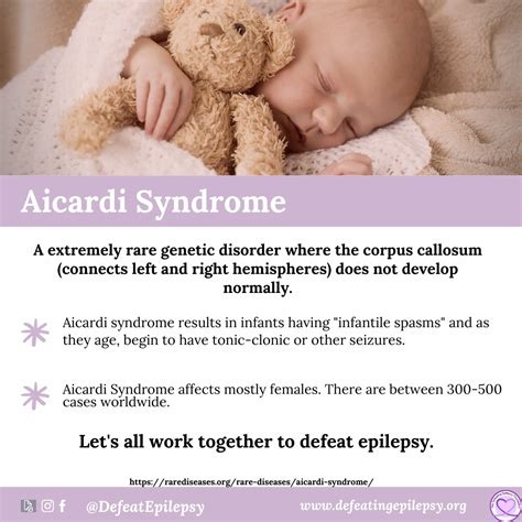 Aicardi Syndrome: Statistics, Symptoms, And Seizure, 50% OFF