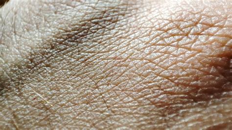 Human Skin Texture. Macro Healthy and Young Hand Skin Stock Photo - Image of design, dark: 226647686