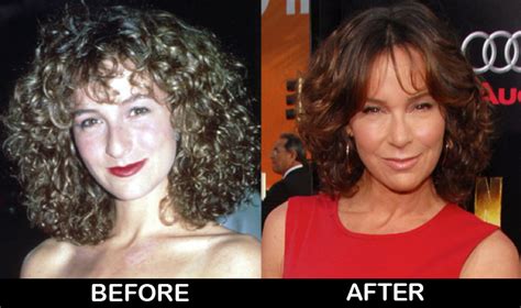 Jennifer Grey Before and After Plastic Surgery Photos | Celebrity ...