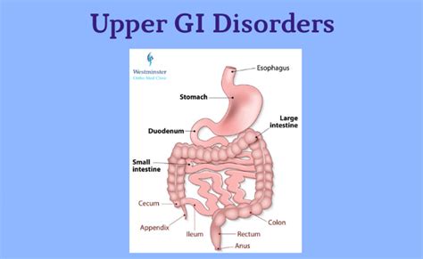 Upper GI Disorders and Management | Dubai, UAE | Westminster Ortho Med ...