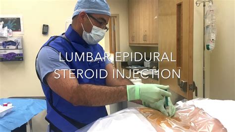 Epidural Steroid Injection Procedure by Eddy Feliz M.D. - YouTube