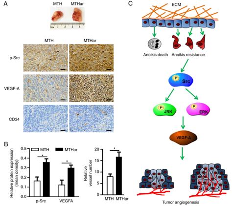 Anoikis‑resistant human osteosarcoma cells display significant angiogenesis by activating the ...