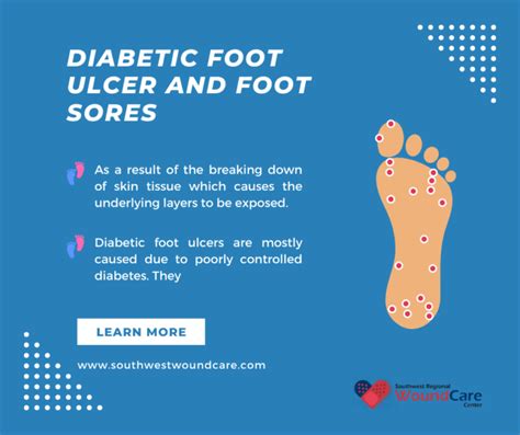 Diabetic Foot Ulcer and Foot Sores Treatment in Lubbock TX