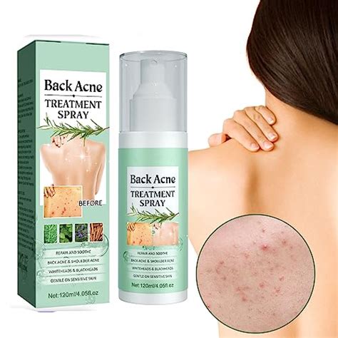 Back Acne Treatment Spray, Back Acne Treatment Spray Acne Spray Back and Chest, Spray for Back ...