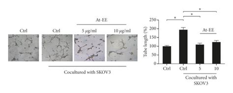 At-EE decreased ovarian cancer-mediated angiogenesis. (a–d) HUVEC cells ...