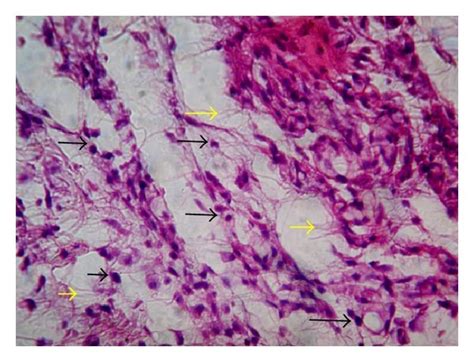 Histopathology of granulation tissue at day 10 stained with H&E (100x).... | Download Scientific ...