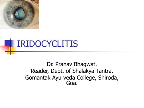 iridocyclitis