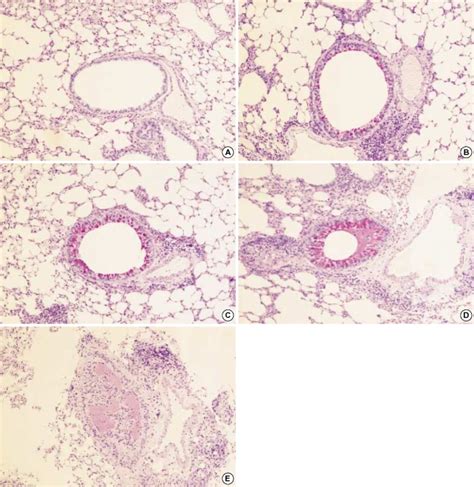 Photomicrographs of PAS stain of lung tissue in each group of mouse... | Download Scientific Diagram