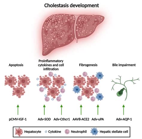 Gene Therapy for Cholestasis | Encyclopedia MDPI