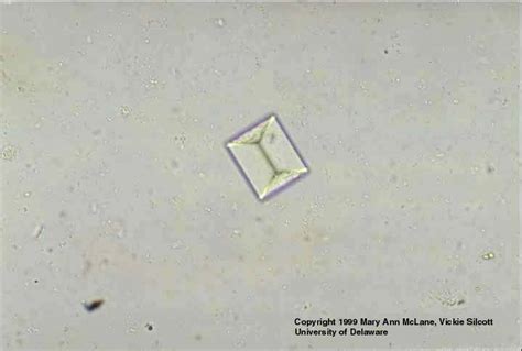 Triple Phosphate Crystals In Human Urine