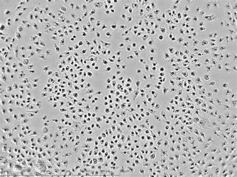 Cytotoxicity assay - zenCELL owl -Microscopy for the incubator