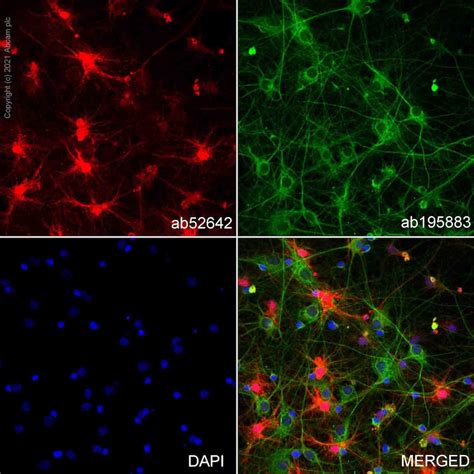 Anti-S100 beta 抗体 [EP1576Y] - Astrocyte Marker (ab52642)