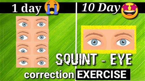 Squint Eye treatment NATURALLY with exercises at Home - YouTube