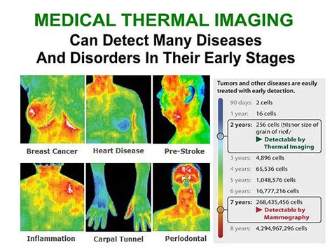 Medical Thermal Imaging - O2 Wellness Center