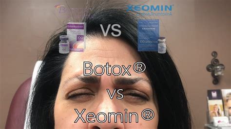 Botox® vs Xeomin® - Which is Better? - YouTube