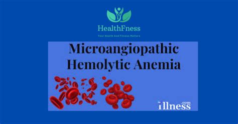 Microangiopathic Hemolytic Anemia: Symptoms, Causes, And Treatment2024 | HealthFness