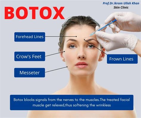 What you might not know about botulinum toxin can also be used to treat migraines and ease the ...