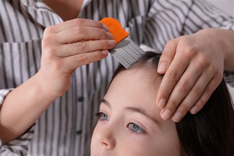 Treating and Preventing Head Lice In Children - Beaumont Emergency Hospital