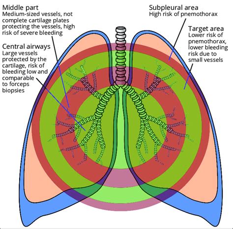 -The biopsies obtained in the periphery of secondary pulmonary lobule... | Download Scientific ...