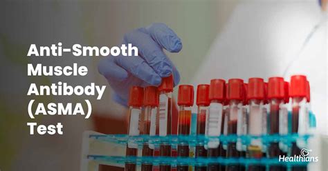 Anti-Smooth Muscle Antibody (ASMA) Test - HEALTHIANS BLOG