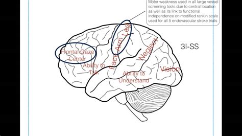 Van Stroke Scale Chart