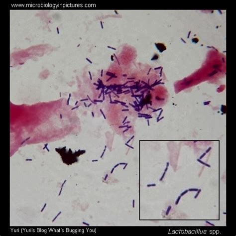 Lactobacillus Gram-stain and cell morphology. Lactobacillus micrograph, appearance under the ...