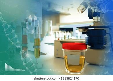 Urine Sample Test Ascorbic Acid Vitamin Stock Illustration 1813824170 | Shutterstock