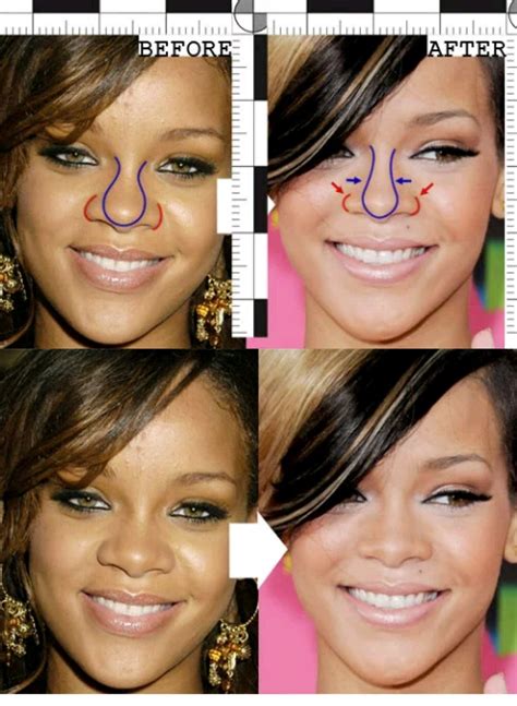 Photos Of Ten Celebrities With Nose Job (rhinoplasty). - Celebrities - Nigeria