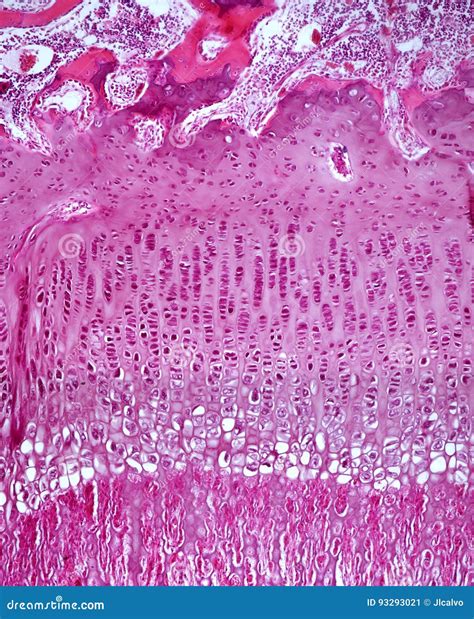 Epiphyseal plate stock image. Image of cartilage, chondrocytes - 93293021