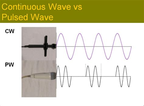 1a. Continuous waves- is a wave that keeps going much like if you keep ...