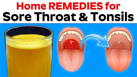 Home REMEDIES for Sore Throat and Swollen Tonsils | Health and Safety | Best Tips for 2019 - YouTube